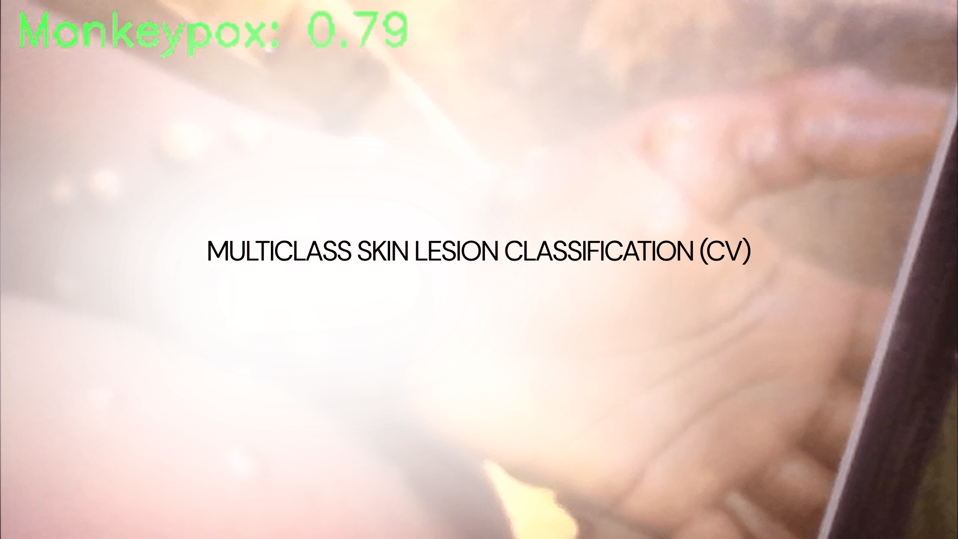 Multiclass Skin Lesion Classification